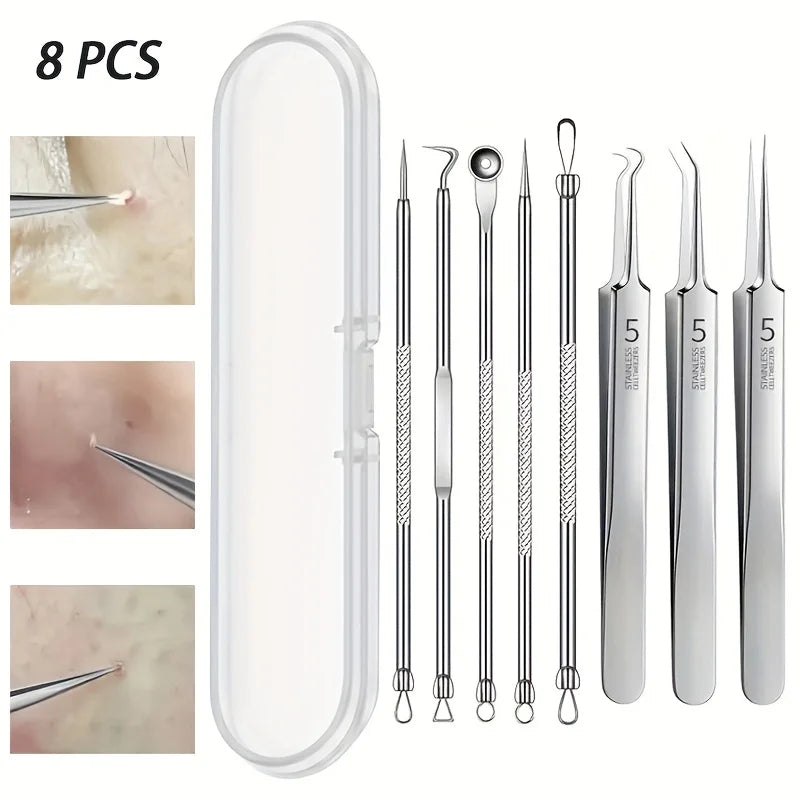 8-Piece Blackhead & Acne Remover Kit