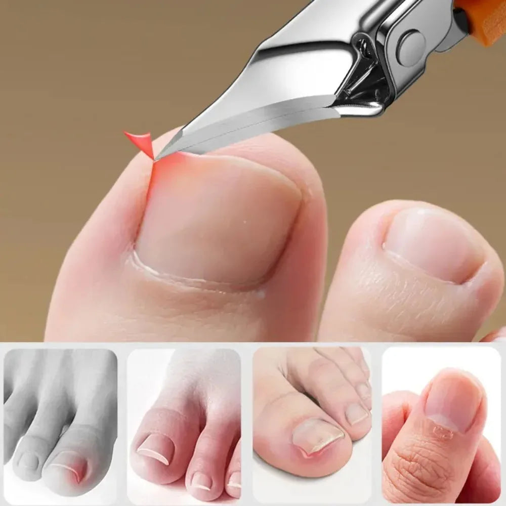 25° Slanted Edge Nail Clipper – Professional Ingrown Toenail Tool
