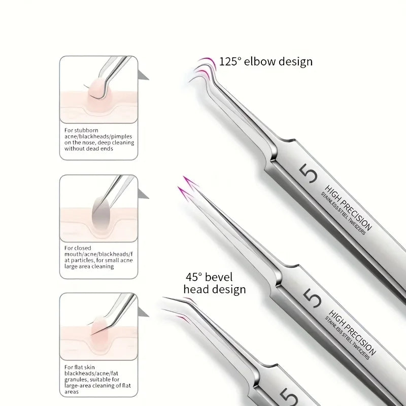 8-Piece Blackhead & Acne Remover Kit